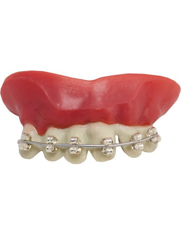 Rovnátka na zubní protézy